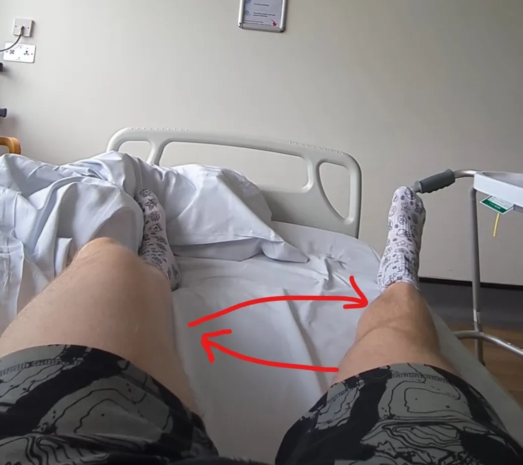 Andrew’s view of his legs on the hospital bed, with red arrows showing the operated leg sliding out to the side and back