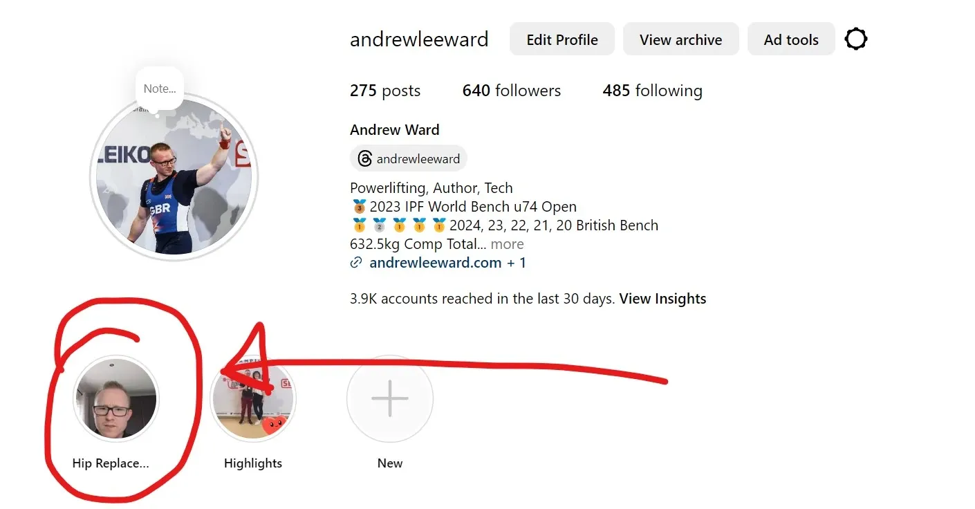 Screenshot of Andrew’s Instagram profile with the ‘Hip Replace…’ highlight circled in red and an arrow pointing to it